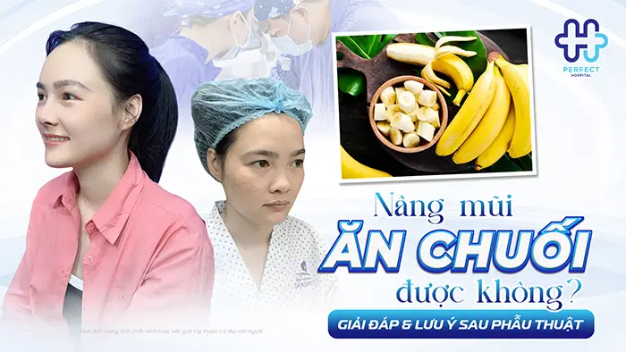 Nâng Mũi Ăn Chuối Được Không? Giải Đáp & Lưu Ý Sau Phẫu Thuật
