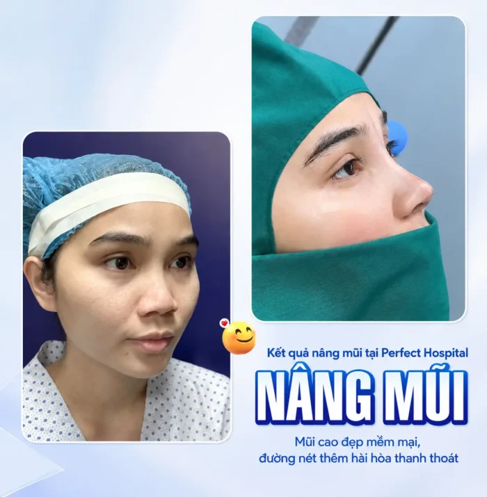 Nâng Mũi Ăn Ếch Được Không? Khi Nào Ăn Thịt Ếch An Toàn