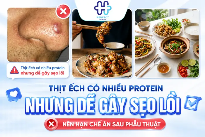 Nâng Mũi Ăn Ếch Được Không? Khi Nào Ăn Thịt Ếch An Toàn