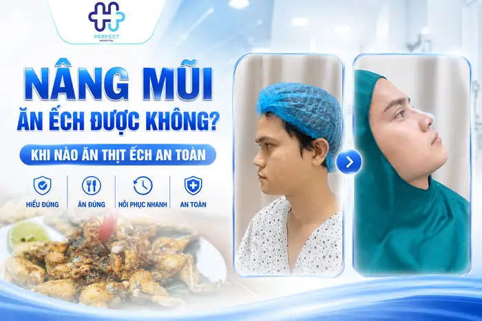 Nâng Mũi Ăn Ếch Được Không? Khi Nào Ăn Thịt Ếch An Toàn