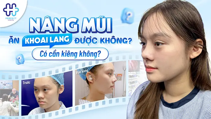 Nâng Mũi Ăn Khoai Lang Được Không? Có Cần Kiêng Không?