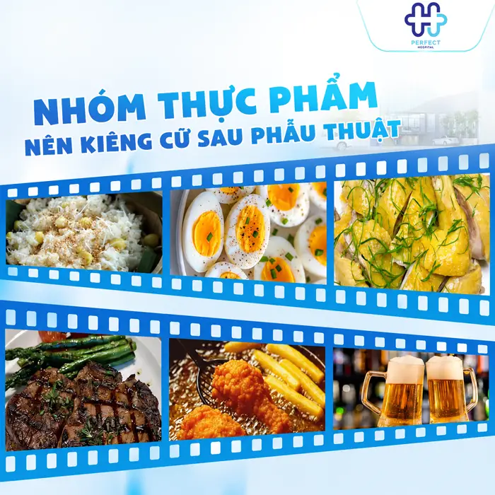 Nâng Mũi Ăn Khoai Tây Được Không? Giải Đáp Từ Bác Sĩ Thẩm Mỹ