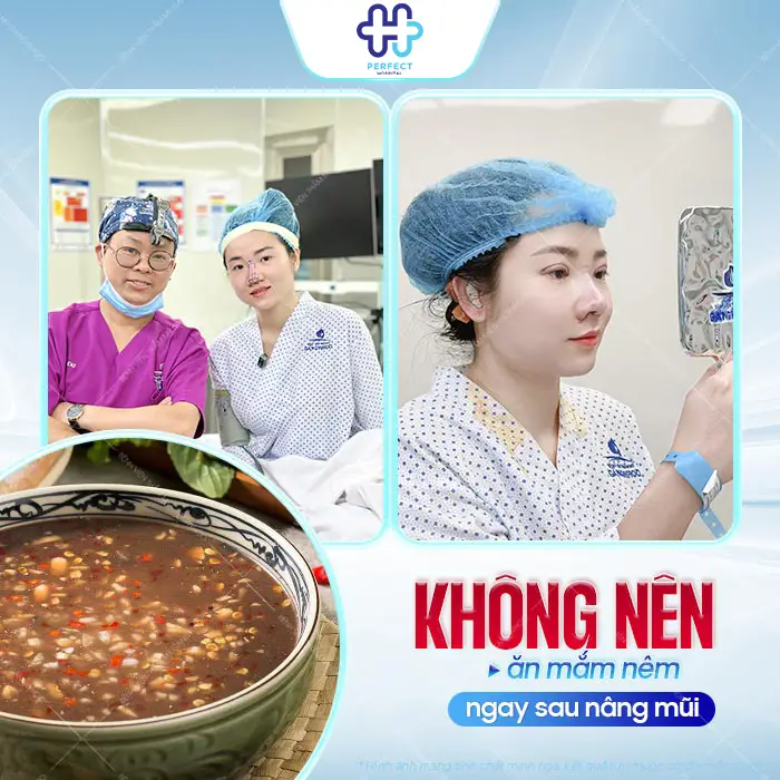 Nâng Mũi Có Ăn Mắm Nêm Được Không? Bao Lâu Thì Ăn Lại An Toàn