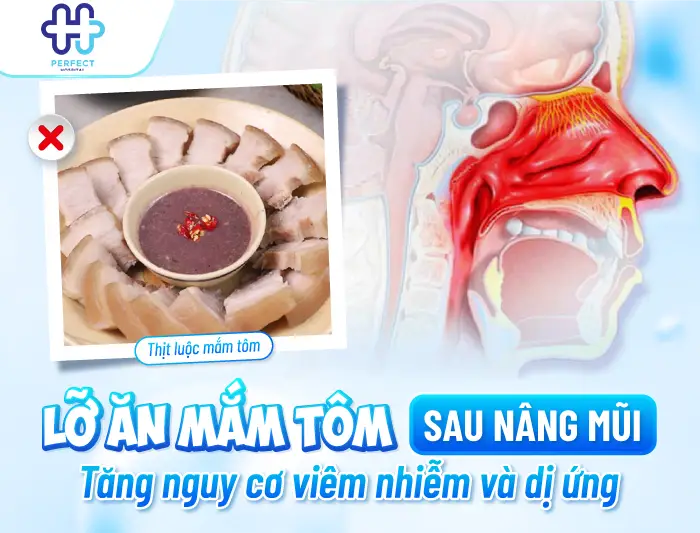 Nâng Mũi Ăn Mắm Tôm Được Không? Bao Lâu Ăn Lại An Toàn