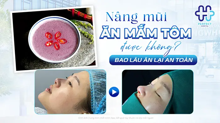 Nâng Mũi Ăn Mắm Tôm Được Không? Bao Lâu Ăn Lại An Toàn