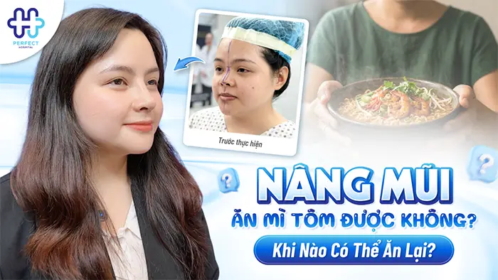 Nâng Mũi Ăn Mì Tôm Được Không? Khi Nào Có Thể Ăn Lại?