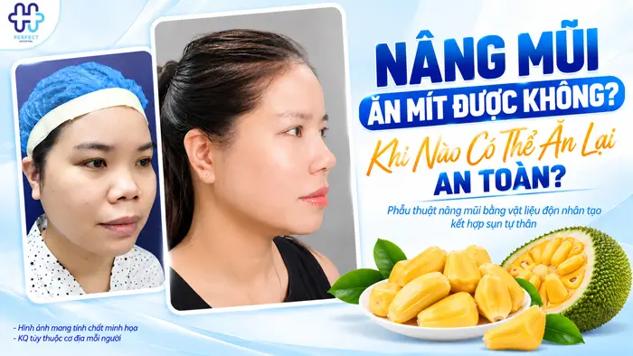Nâng Mũi Ăn Mít Được Không? Khi Nào Có Thể Ăn Lại An Toàn?