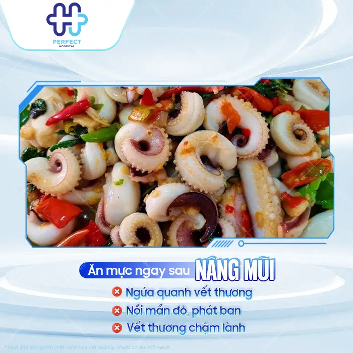 Nâng Mũi Có Được Ăn Mực Không Và Khi Nào Ăn Lại An Toàn