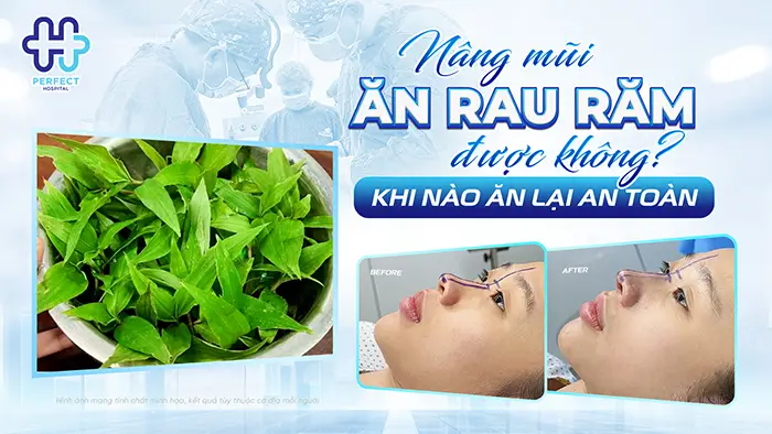 Nâng Mũi Ăn Rau Răm Được Không Và Khi Nào Ăn Lại An Toàn
