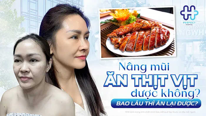 Nâng Mũi Có Được Ăn Thịt Vịt Không? Bao Lâu Thì Ăn Lại Được?