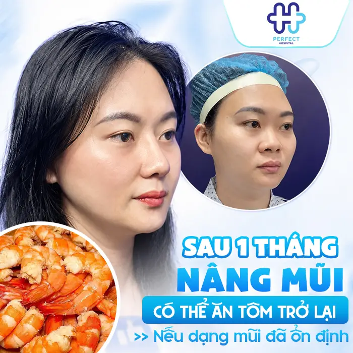 Nâng Mũi Có Được Ăn Tôm Không Và Khi Nào Ăn Lại An Toàn