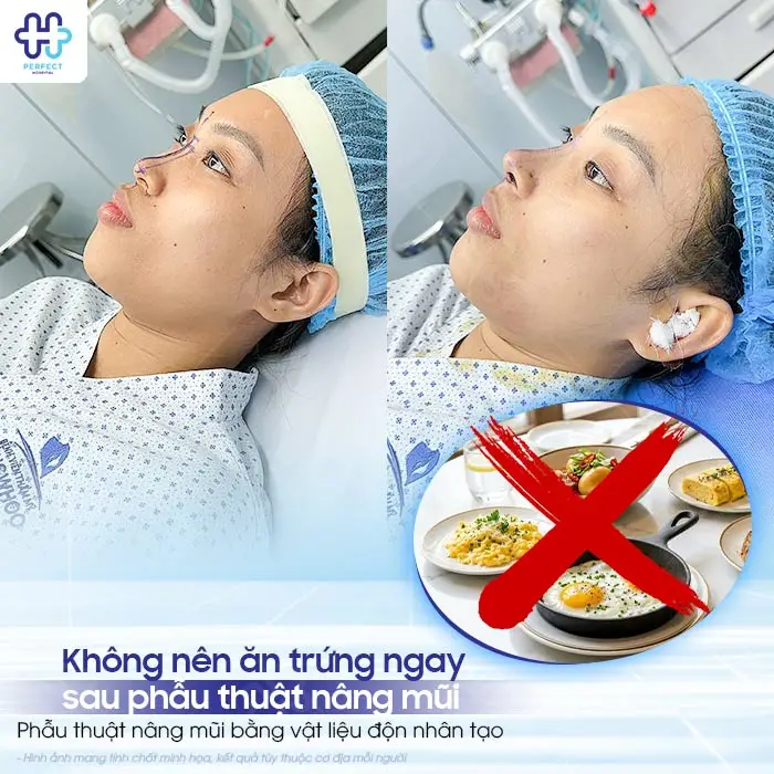Nâng mũi ăn trứng được không? Có cần kiêng trứng không?