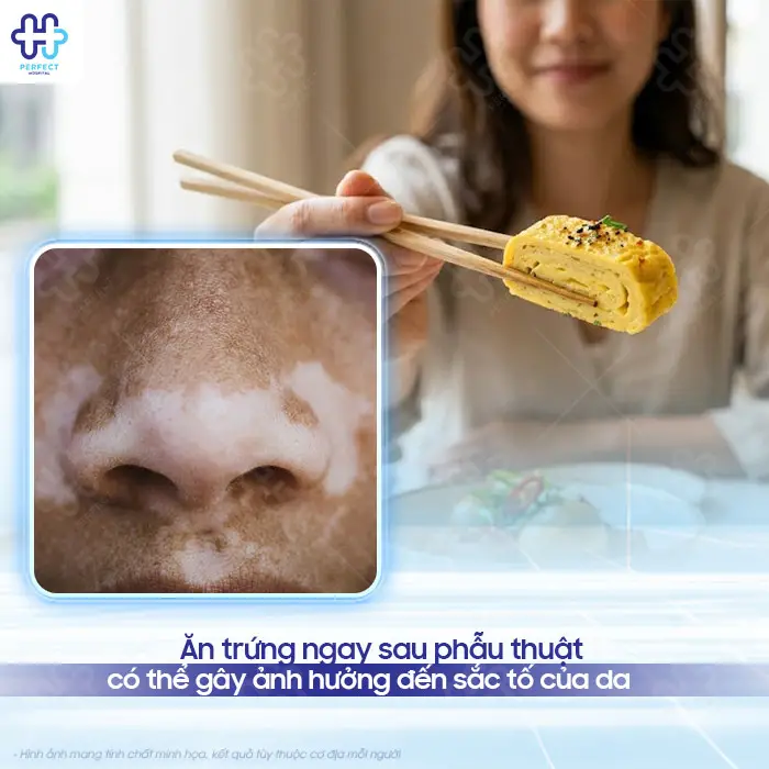 Nâng mũi ăn trứng được không? Có cần kiêng trứng không?