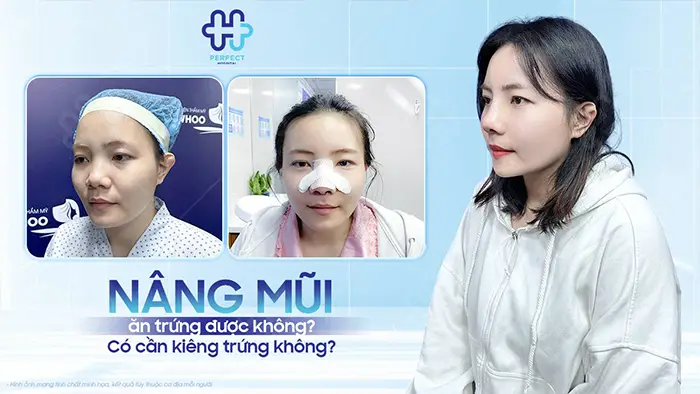 Nâng mũi ăn trứng được không? Có cần kiêng trứng không?