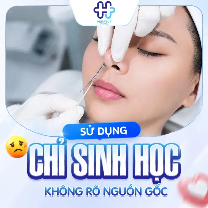 Nâng Mũi Chỉ Có Biến Chứng Không? Có Nên Thực Hiện Hay Không?