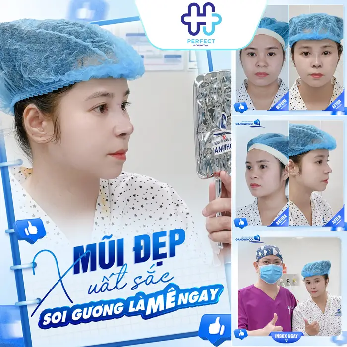 Nâng Mũi Bằng Phương Pháp Nào An Toàn Nhất Hiện Nay