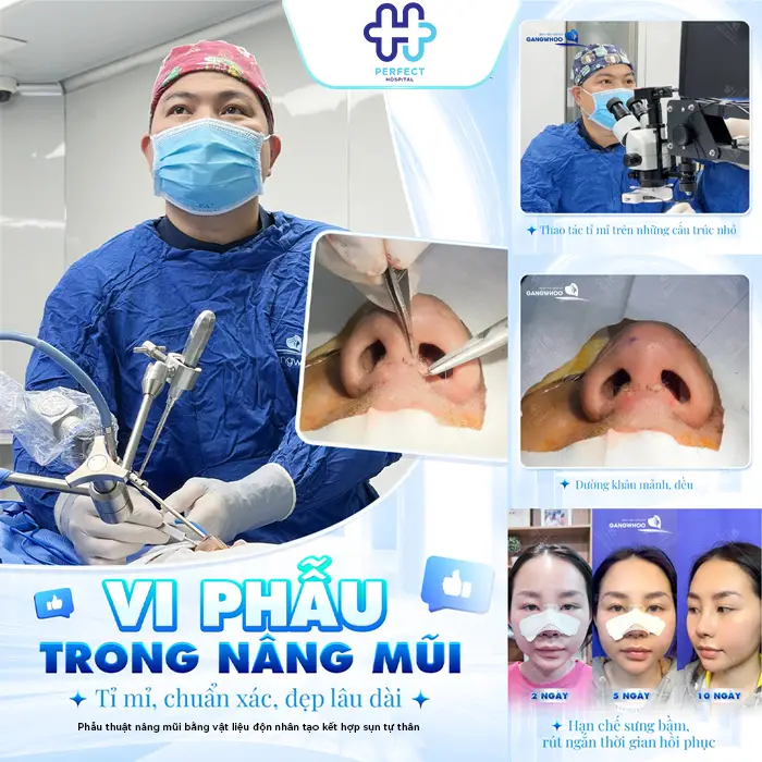 Nâng Mũi Bằng Sụn Có Vĩnh Viễn Không? Cùng Bác Sĩ Giải Đáp