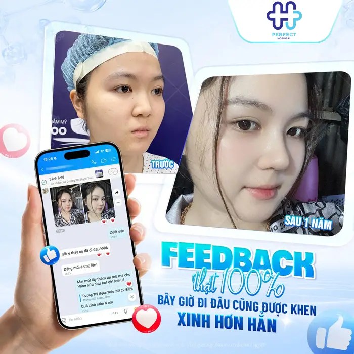 Nâng Mũi Bằng Sụn Có Vĩnh Viễn Không? Cùng Bác Sĩ Giải Đáp