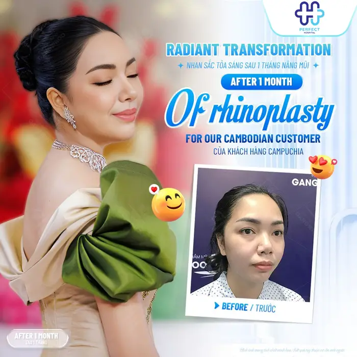 Nâng Mũi Bằng Sụn Tai Có Tốt Không? Có An Toàn Không