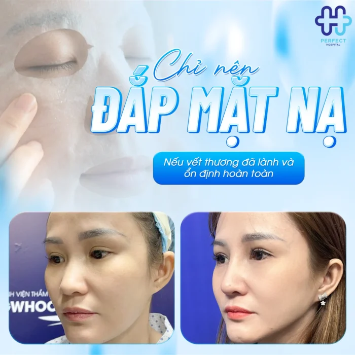 Nâng Mũi Bao Lâu Được Đắp Mặt Nạ Để Không Ảnh Hưởng Dáng Mũi