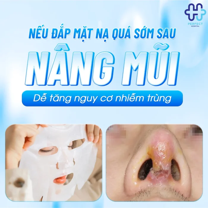 Nâng Mũi Bao Lâu Được Đắp Mặt Nạ Để Không Ảnh Hưởng Dáng Mũi