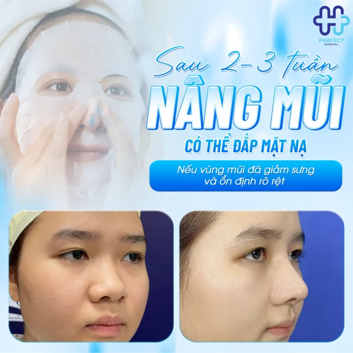 Nâng Mũi Bao Lâu Được Đắp Mặt Nạ Để Không Ảnh Hưởng Dáng Mũi