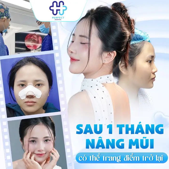 Nâng Mũi Bao Lâu Được Trang Điểm? Thời Điểm Makeup An Toàn
