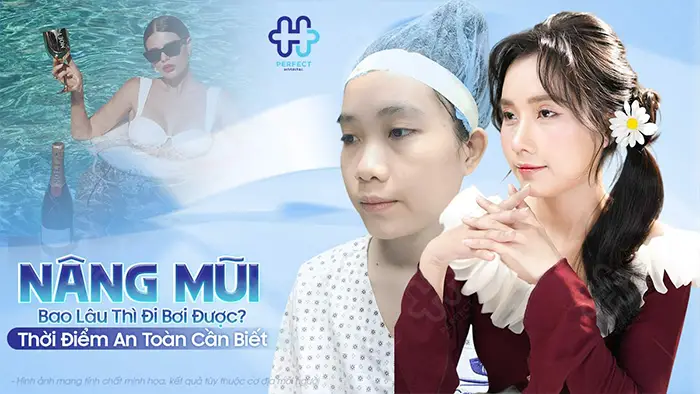 Nâng Mũi Bao Lâu Thì Đi Bơi Được? Thời Điểm An Toàn Cần Biết