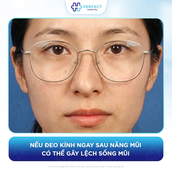 Nâng Mũi Bao Lâu Thì Được Đeo Kính An Toàn Không Ảnh Hưởng Dáng