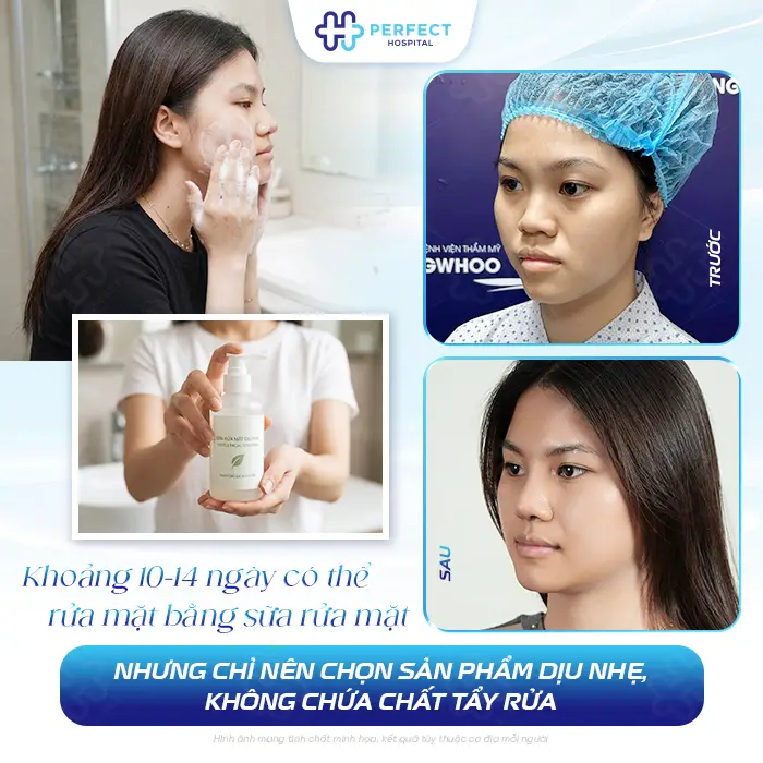 Nâng Mũi Bao Lâu Thì Được Dùng Sữa Rửa Mặt An Toàn Cho Mũi