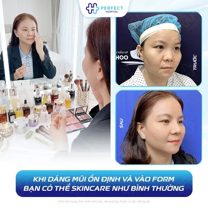 Nâng Mũi Bao Lâu Thì Được Dùng Sữa Rửa Mặt An Toàn Cho Mũi