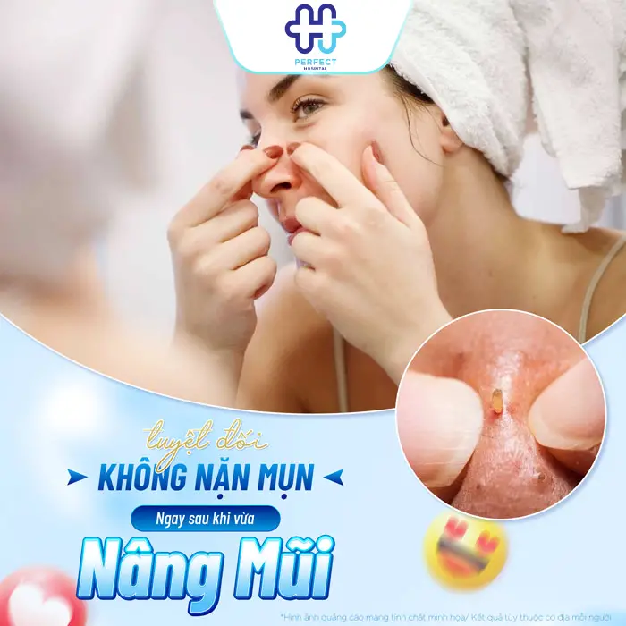 Nâng Mũi Bao Lâu Thì Được Nặn Mụn? Bác Sĩ Giải Đáp An Toàn