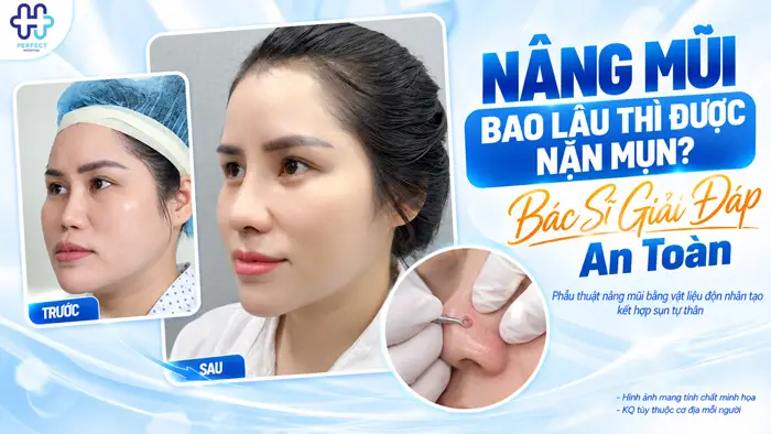Nâng Mũi Bao Lâu Thì Được Nặn Mụn? Bác Sĩ Giải Đáp An Toàn