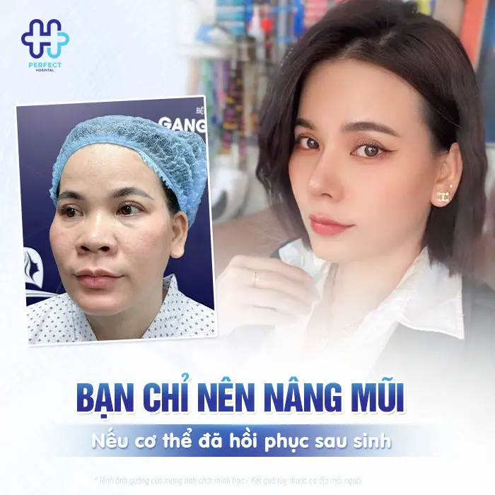 Nâng Mũi Bao Lâu Thì Mang Thai Được? Bác Sĩ Giải Đáp Chi Tiết