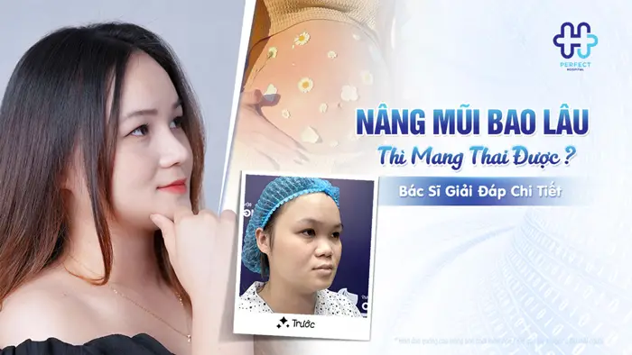 Nâng Mũi Bao Lâu Thì Mang Thai Được? Bác Sĩ Giải Đáp Chi Tiết
