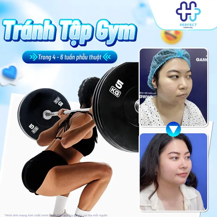 Nâng Mũi Bao Lâu Thì Tập Gym Được Và Thời Điểm An Toàn Nhất