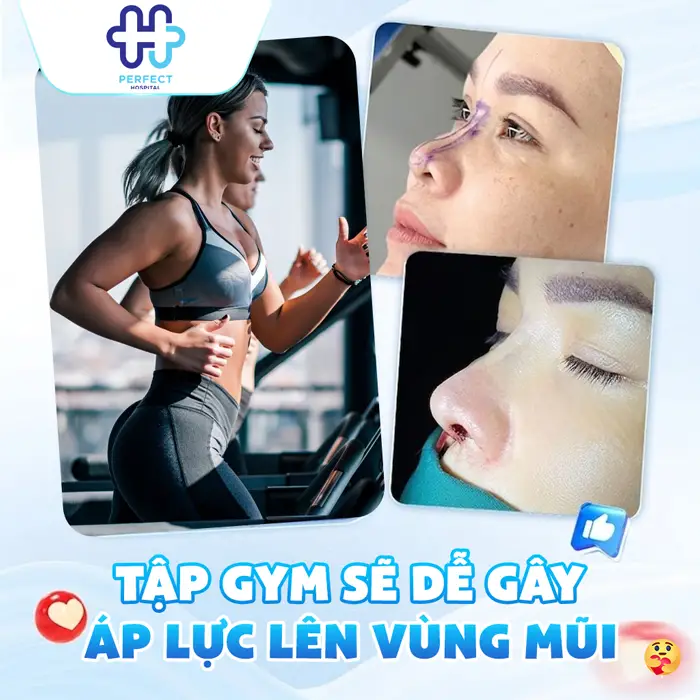 Nâng Mũi Bao Lâu Thì Tập Gym Được Và Thời Điểm An Toàn Nhất