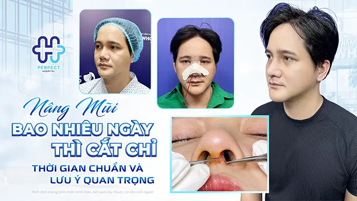 Nâng Mũi Bao Nhiêu Ngày Cắt Chỉ? Thời Gian Chuẩn Và Lưu Ý Quan Trọng
