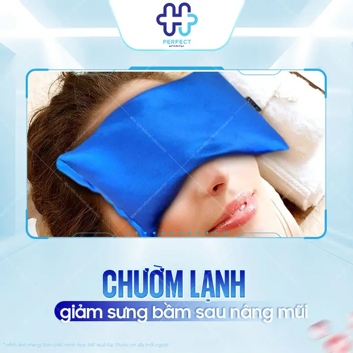 Nâng Mũi Bị Bầm Mắt Có Sao Không Và Cách Giảm Tím Nhanh