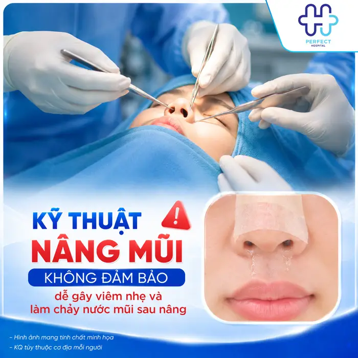 Chảy Nước Mũi Sau Khi Nâng Mũi Có Nguy Hiểm Không Và Cách Xử Lý