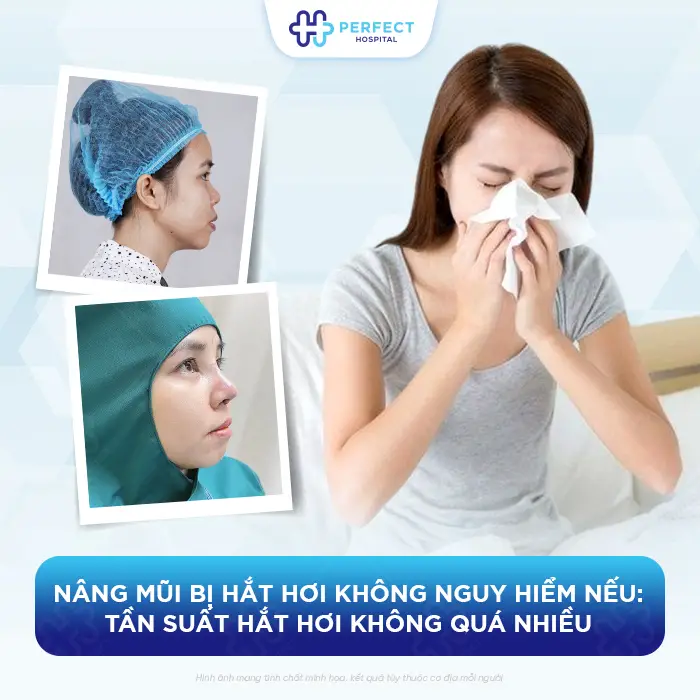 Nâng Mũi Bị Hắt Hơi Có Sao Không Và Có Được Xì Mũi Không