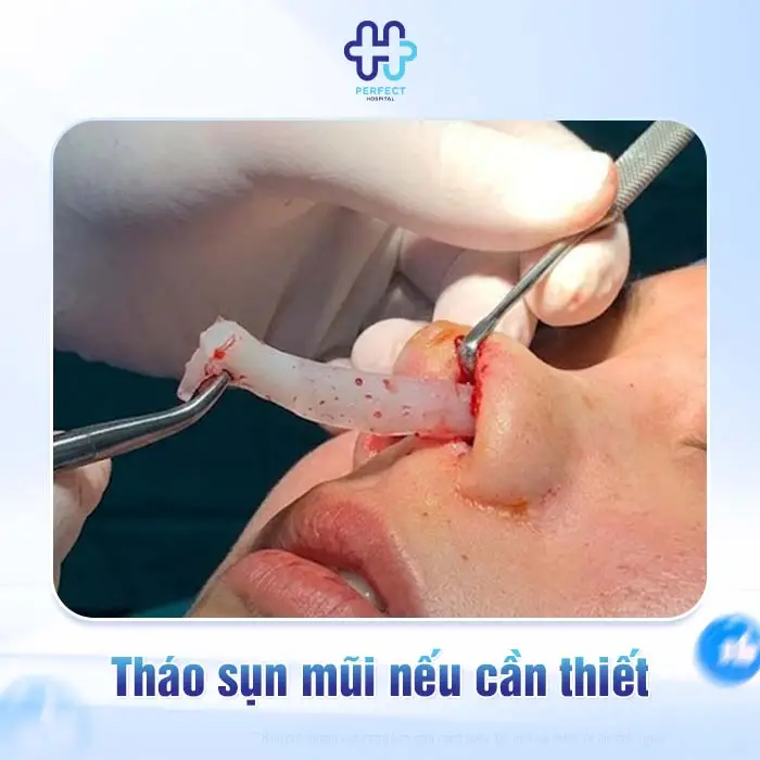 Nâng Mũi Bị Hở Vết Thương Có Nguy Hiểm Không Và Cách Xử Lý An Toàn