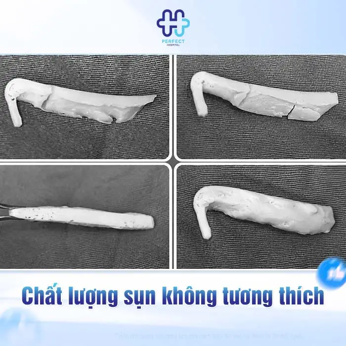 Nâng Mũi Bị Hở Vết Thương Có Nguy Hiểm Không Và Cách Xử Lý An Toàn
