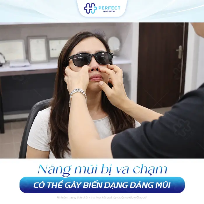 Nâng Mũi Bị Va Chạm Có Sao Không? Cách Xử Lý An Toàn