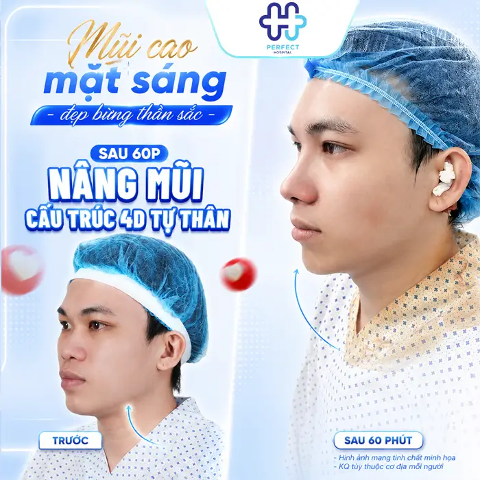 Nâng Mũi Cấu Trúc 4D Tự Thân Là Gì? Có Nên Thực Hiện Không?