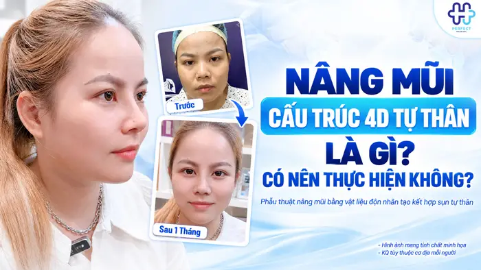 Nâng Mũi Cấu Trúc 4D Tự Thân Là Gì? Có Nên Thực Hiện Không?
