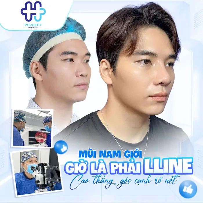 Nâng Mũi Cấu Trúc Bao Lâu Thì Gom Lại Và Vào Form Đẹp?
