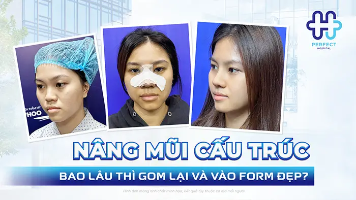 Nâng Mũi Cấu Trúc Bao Lâu Thì Gom Lại Và Vào Form Đẹp?