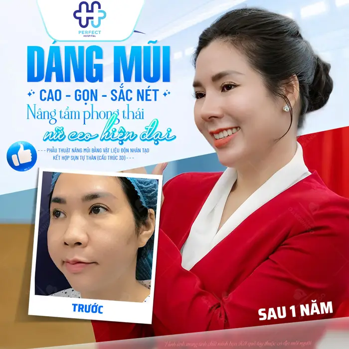 Nâng Mũi Cấu Trúc Có An Toàn Không? Giải Đáp Từ Chuyên Gia
