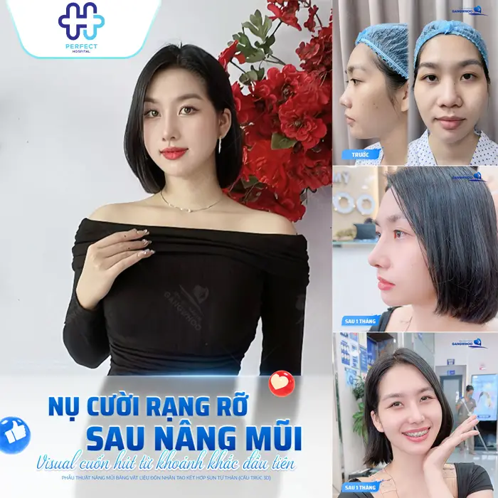Nâng Mũi Cấu Trúc Có An Toàn Không? Giải Đáp Từ Chuyên Gia